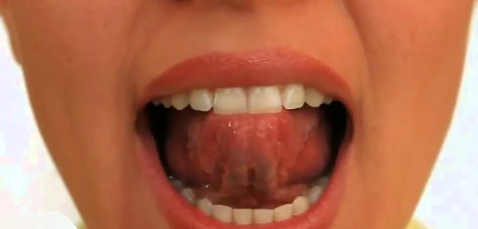 FOTO: Diksiyon Alıştırmaları